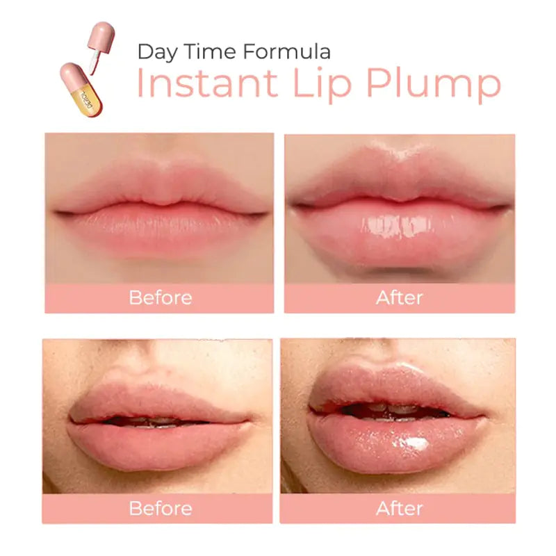 Derol Lip Plumper Kit 