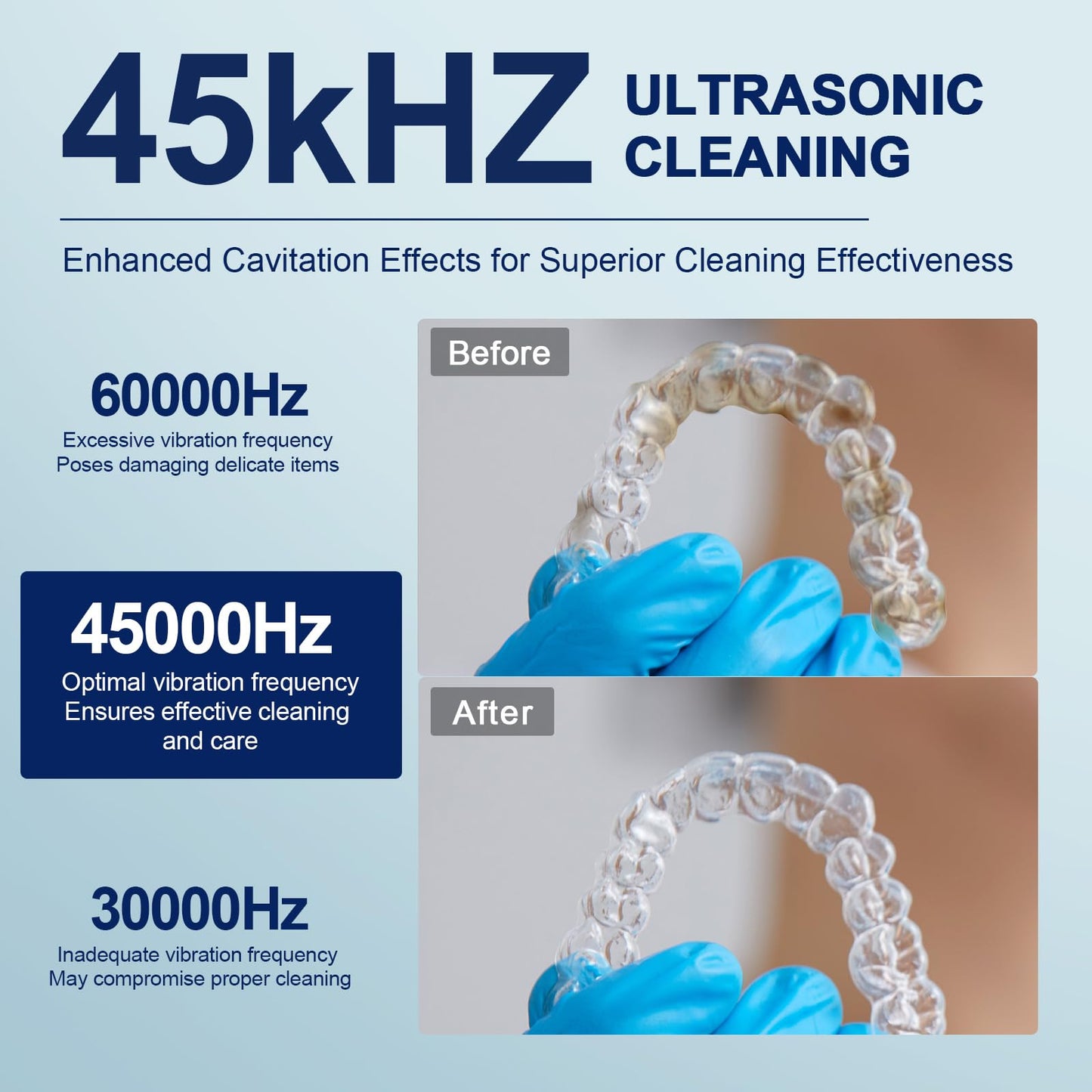 Upgraded Ultrasonic Retainer Cleaner, 45kHz Retainer Cleaner Machine for Denture Cleaner, Retainer Cleaner, Mouth Guard Cleaner, Night Guard Cleaner, Denture Cleaner with 200ML Dental Cleaning Pod