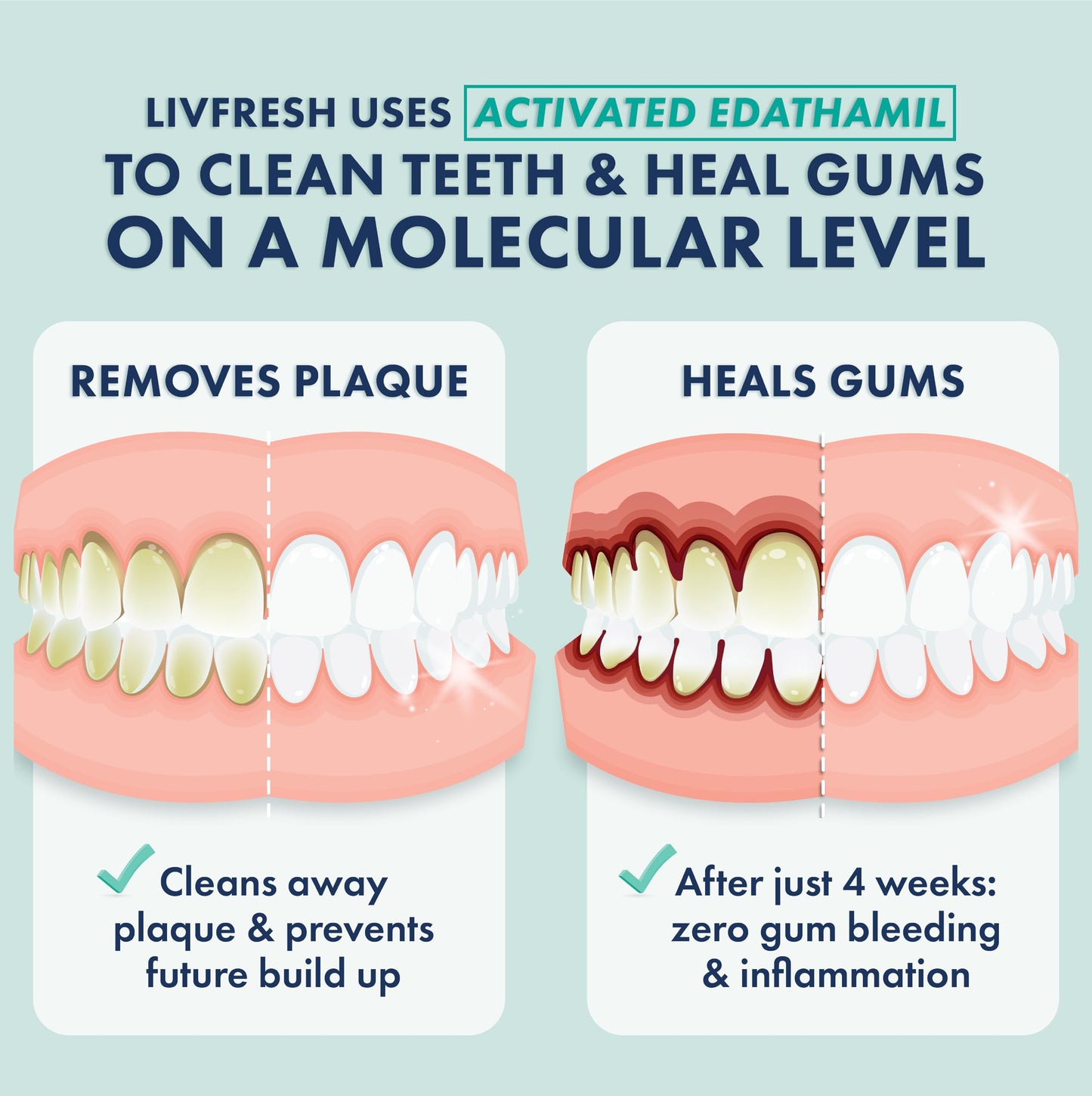 LIVFRESH Toothpaste Gel, Clinically Proven to Remove Plaque 250% Better, Improves Gum Health 190% Better, Prevents & Reduces Tartar, Freshens Breath, SLS Free Dental Gel, Wintergreen